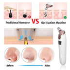 Electric Face Vacuum Blackhead Remover & Pore Cleaner | Deep Cleansing Tool for Nose and Face - SS Smart Store